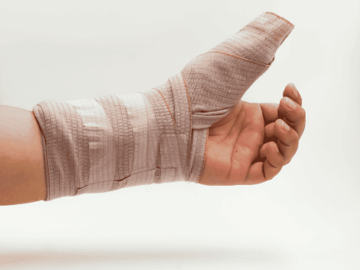 How to Describe Broken Bones in Writing